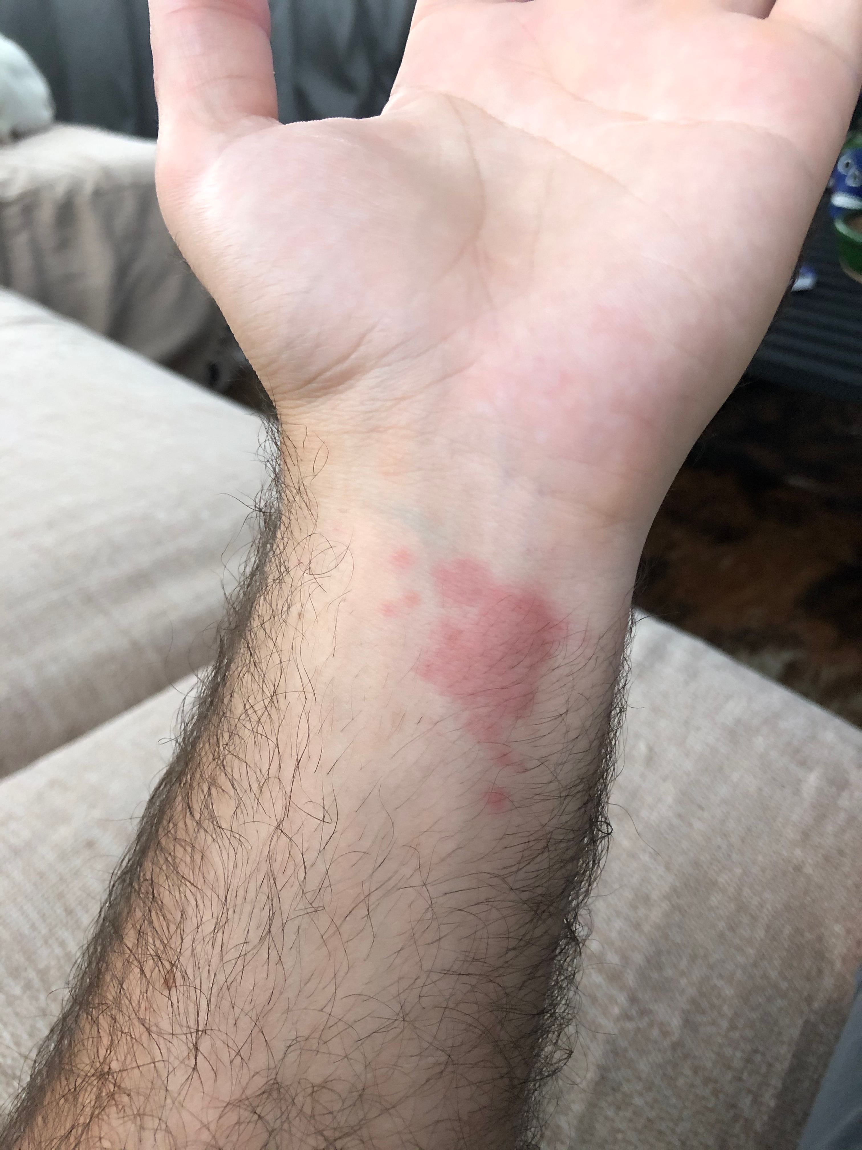 Itching that won’t go away?