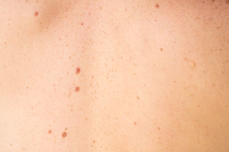 spot skin